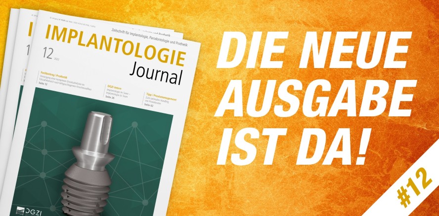 Dezemberausgabe des Implantologie Journal ab jetzt verfügbar