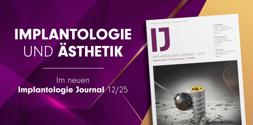 Jetzt online lesen: Ästhetische Konzepte im Implantologie Journal 12/25