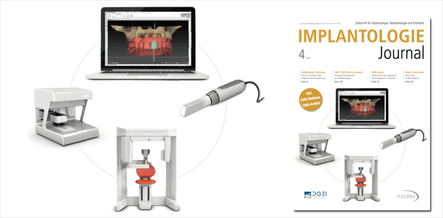 Aktuelles Implantologie Journal ab sofort verfügbar