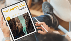 GBR- und GTR-Konzepte im aktuellen Implantologie Journal