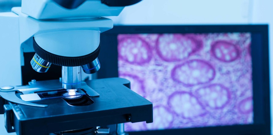 Erstmals nachgewiesen: Immunzelle hemmt Tumorwachstum