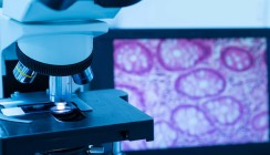 Erstmals nachgewiesen: Immunzelle hemmt Tumorwachstum