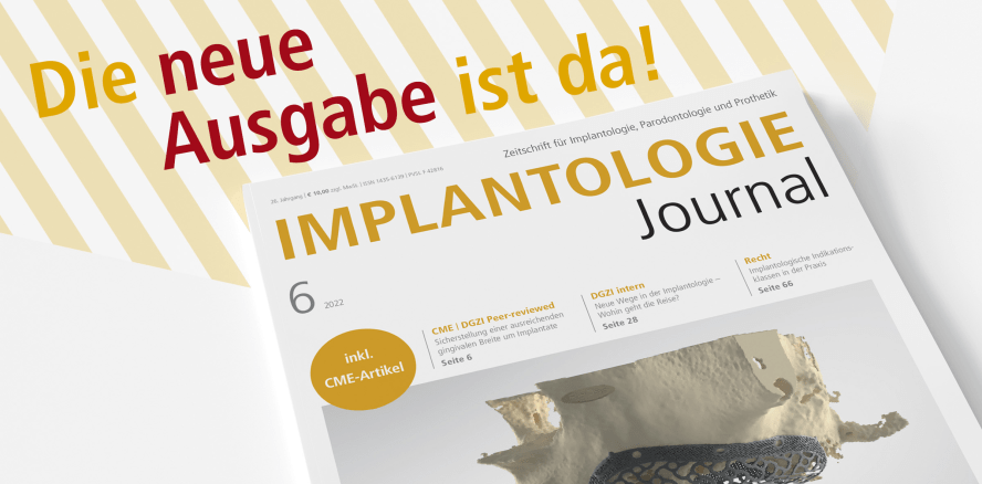 Aktuelles Implantologie Journal legt Fokus auf GBR und GTR