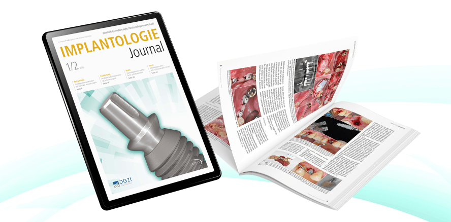 Implantologie Journal: Erste Ausgabe 2022 erschienen