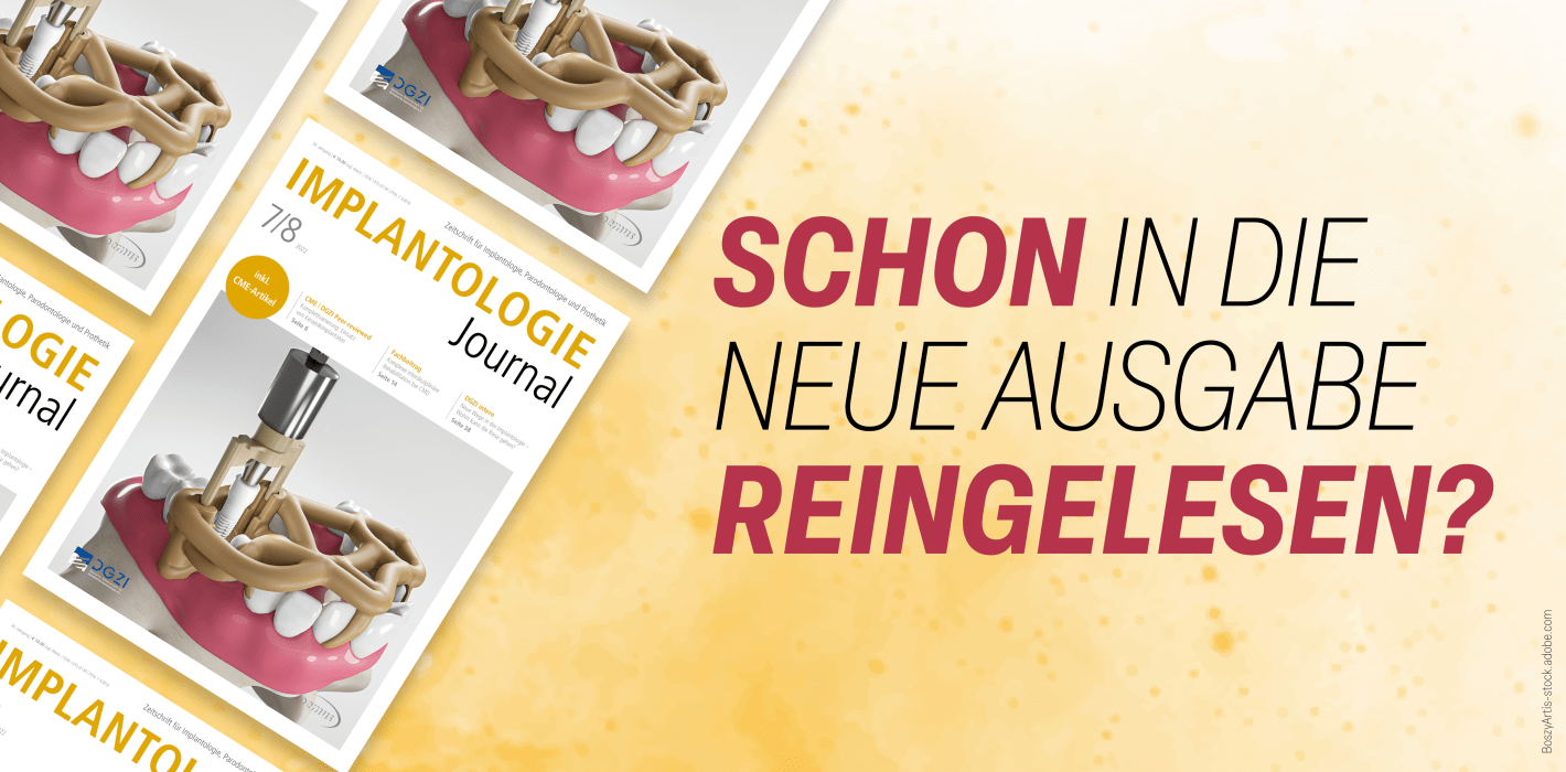 Jetzt online: Sommerausgabe des Implantologie Journals