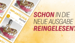 Jetzt online: Sommerausgabe des Implantologie Journals