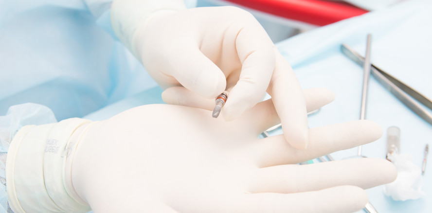 Intelligente Zahnimplantate für eine längere Lebensdauer