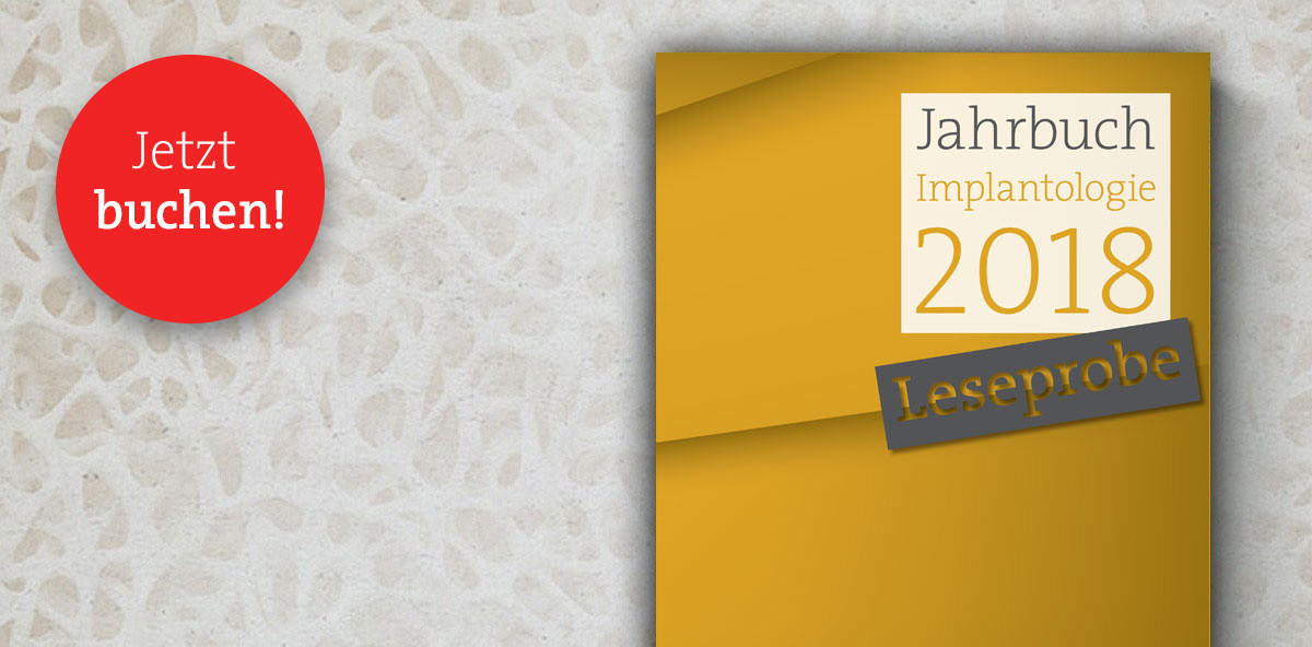 „Jahrbuch Implantologie 2018“ – Jetzt Firmenpräsentation sichern!