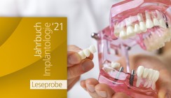 „Jahrbuch Implantologie 2021“: Leseprobe ab sofort online