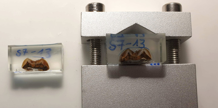 Studie bestätigt: Zahnschmelz verrät Lebensgeschichte