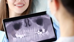 KI in der Zahnmedizin: KI interpretiert Röntgenbilder