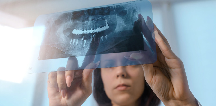 KI als Hilfsmittel zur Interpretation von Zahnröntgenbildern