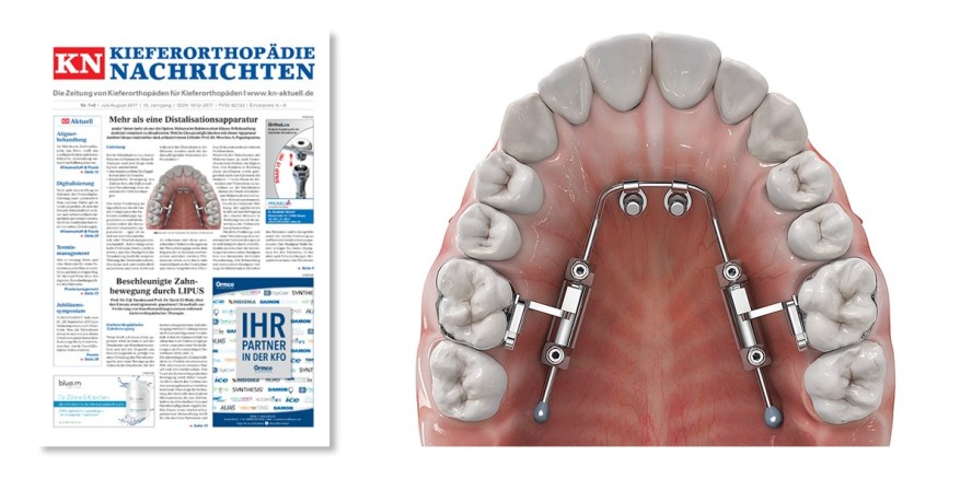 Vorab als ePaper: Neue Ausgabe der Kieferorthopädie Nachrichten