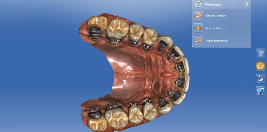 Digitaler Workflow in der kieferorthopädischen Praxis 2.0