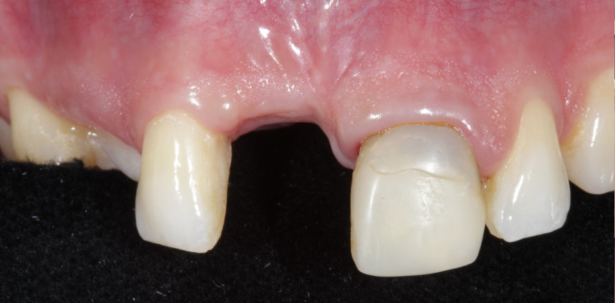 Keramiksymposium 2020: Behandlungserfolg nach Plan