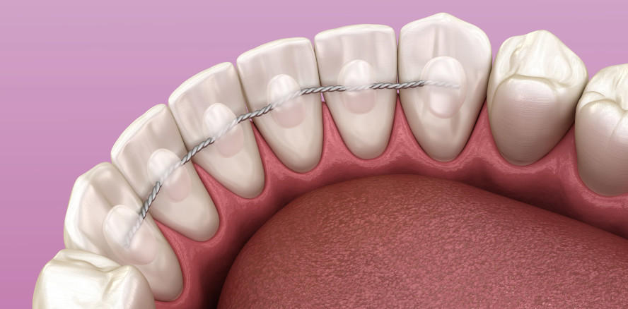 Kieferorthopäden üben Kritik an Bundesverwaltungsgericht