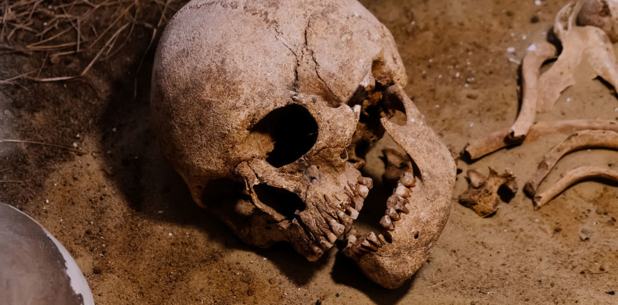 Studie: Kaum Karies bei Kindern in der Bronzezeit