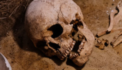 Studie: Kaum Karies bei Kindern in der Bronzezeit