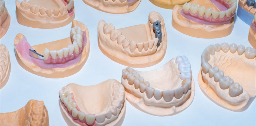 Klaus-Kanter-Preis 2022: Oscars der Zahntechnik verliehen