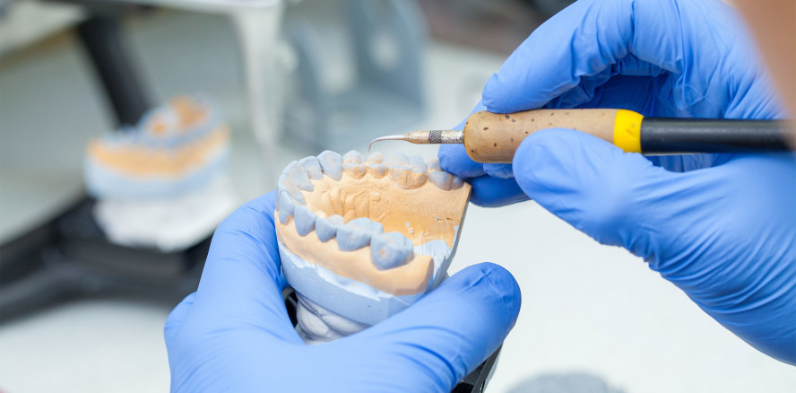 Praxislabor: Leistungen als kalkulatorischen Gewinn berechnen