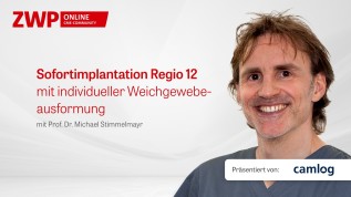 Sofortimplantation Regio 12 mit indiviudeller Weichgewebeausformung