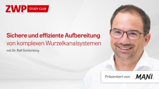 Sichere und effiziente Aufbereitung von komplexen Wurzelkanalsystemen mit JIZAI by MANI new generation NITI files