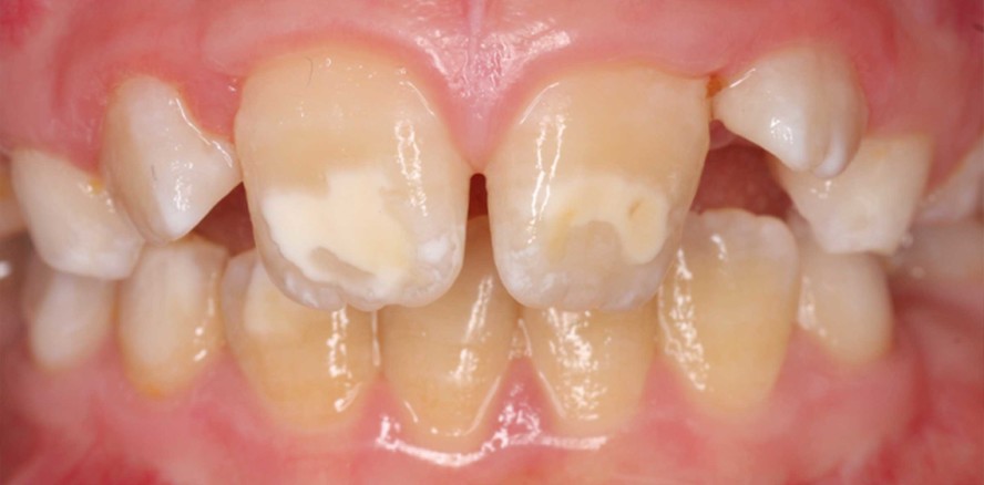 Für die MIH gibt es kein "One fits all"-Konzept!