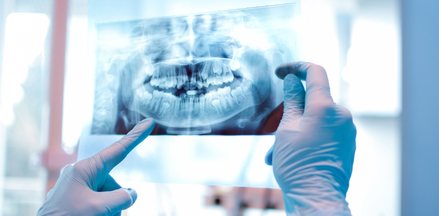 TÜV: Mängel an Röntgengeräten in Zahnarztpraxen und Kliniken