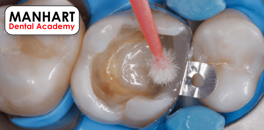 Komposite 2022 – Bewährte Protokolle und aktuelle Trends