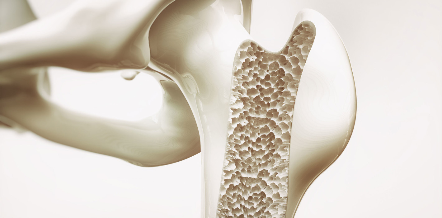 Schweiz: Neue Methode zum Drucken von Knochen