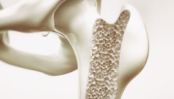 Schweiz: Neue Methode zum Drucken von Knochen