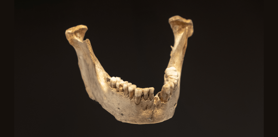 Zähne aus der Bronzezeit veran­schaulichen Ernährungs-Evolution