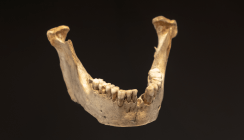 Zähne aus der Bronzezeit veran­schaulichen Ernährungs-Evolution
