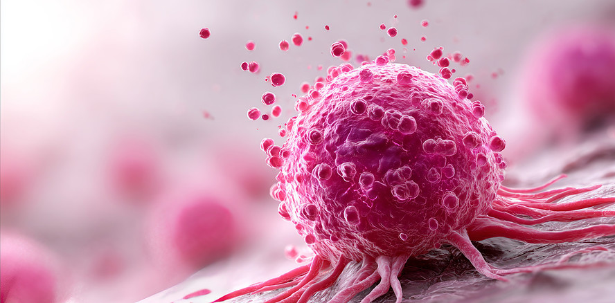 Molekulare Signatur für aggressives Wachstum von Kopf-Hals-Tumoren entdeckt