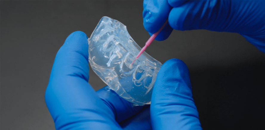 Fixiert, präpariert, polymerisiert: Sichtbarer Erfolg im wahrsten Sinne des Wortes