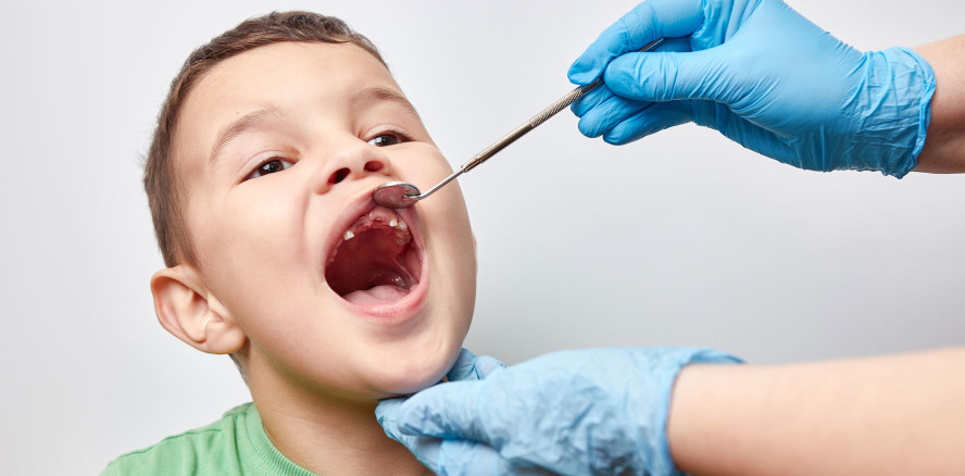 Mütterliche Ernährung als Indikator bei Kinderkaries