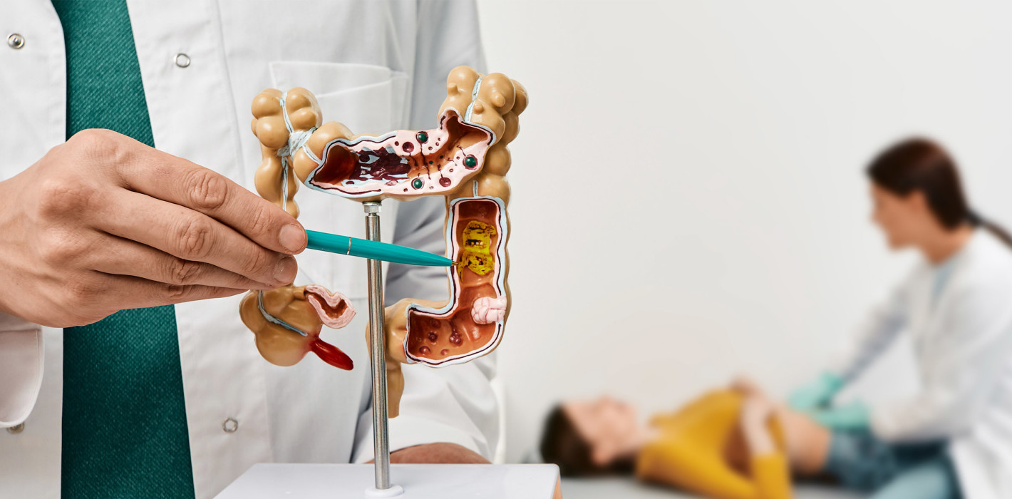 Mundgesundheit bei Patienten mit entzündlichen Darmerkrankungen