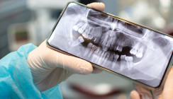 Mundkrebs-Früherkennung mit dem Handy: Forscher testen neues Diagnoseverfahren