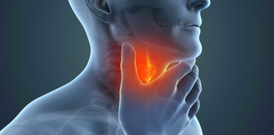 Mundkrebsrate erreicht Rekordhoch