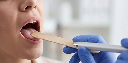 Mundsoor bei Erwachsenen: Woher er kommt und was hilft