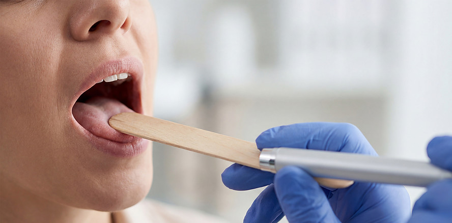 Mundsoor bei Erwachsenen: Woher er kommt und was hilft