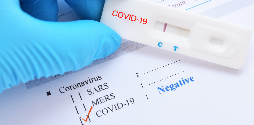 Schnelltestergebnis: Update der Muster-Arbeitgeber-Bescheinigung