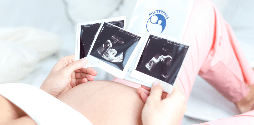 Muss ich meinem Arbeitgeber den Mutterpass zeigen?