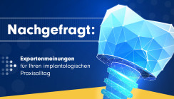 So macht's der Profi: Rubrik Nachgefragt geht Expertenwissen der Implantologie auf den Grund