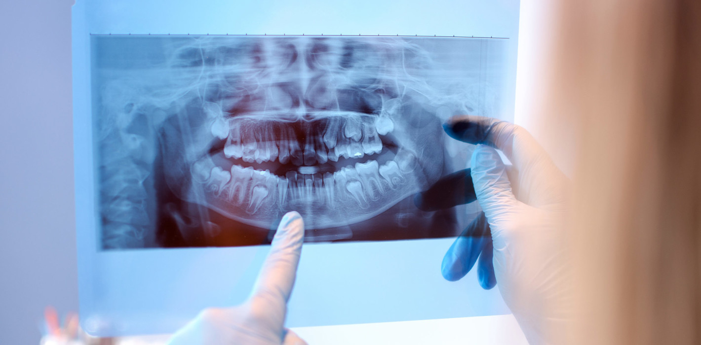 Röntgen – neue gesetzliche Bestimmungen ab 1. Januar 2023
