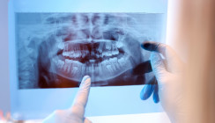Röntgen – neue gesetzliche Bestimmungen ab 1. Januar 2023