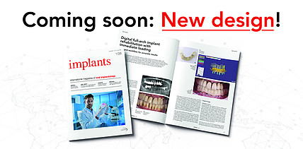 implants mit komplettem Relaunch: neues Design, klarere Struktur, stärkerer Journal-Charakter