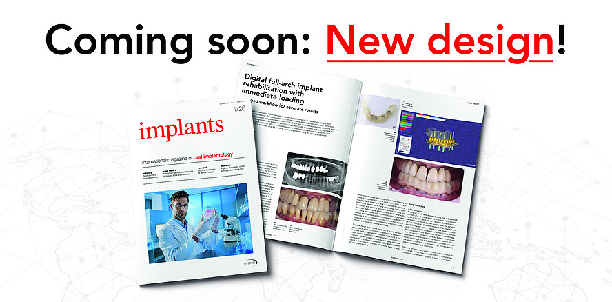 implants mit komplettem Relaunch: neues Design, klarere Struktur, stärkerer Journal-Charakter