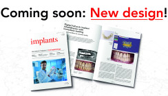 implants mit komplettem Relaunch: neues Design, klarere Struktur, stärkerer Journal-Charakter