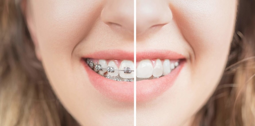 Nichtabrechenbarkeit nicht delegierbarer Leistungen